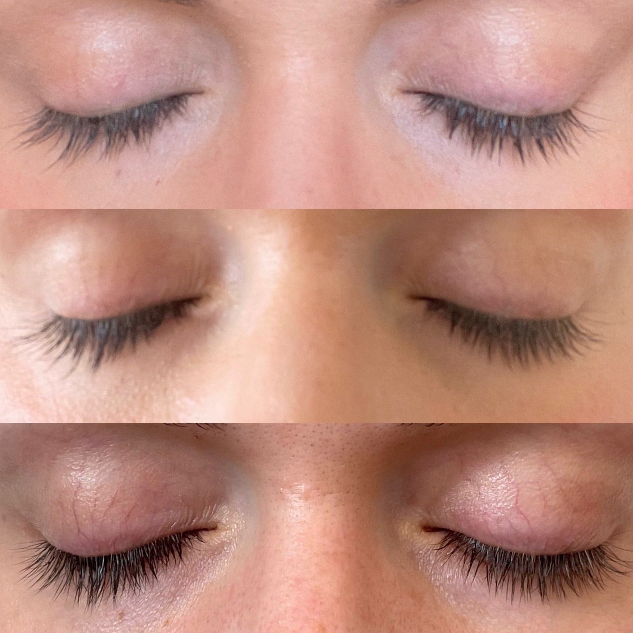 Growth Serum